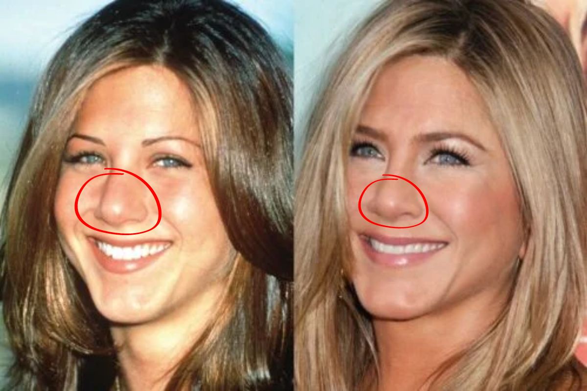 Jennifer Aniston Nose Job