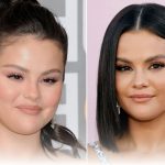 Selena Gomez Plastic Surgery