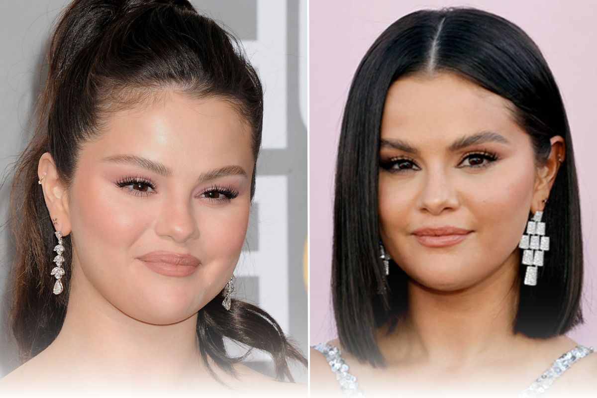 The Truth About Selena Gomez Plastic Surgery