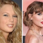 Taylor Swift Plastic Surgery