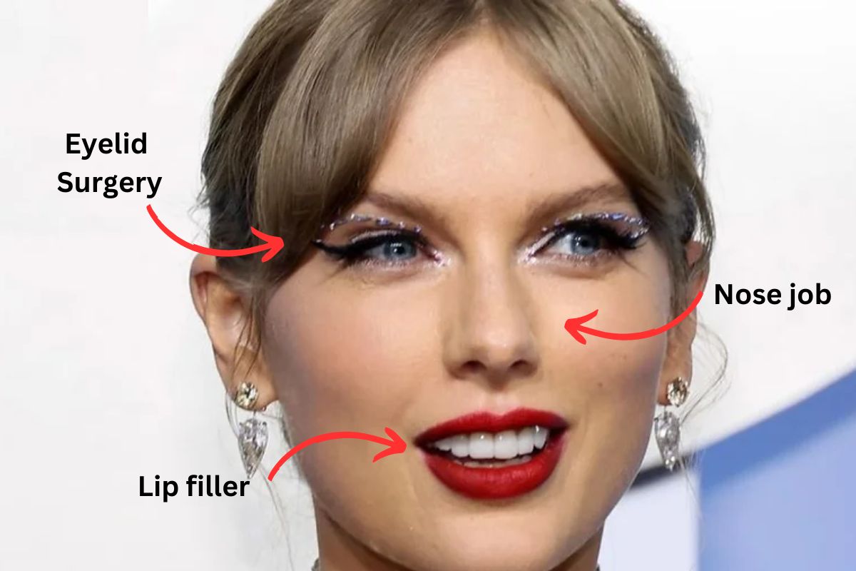 Taylor Swift Plastic Surgery 