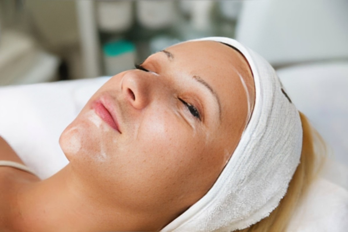 chemical peel