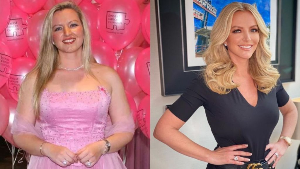 michelle mone before after plastic surgery