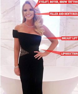 michelle-mone-each-plastic-surgery