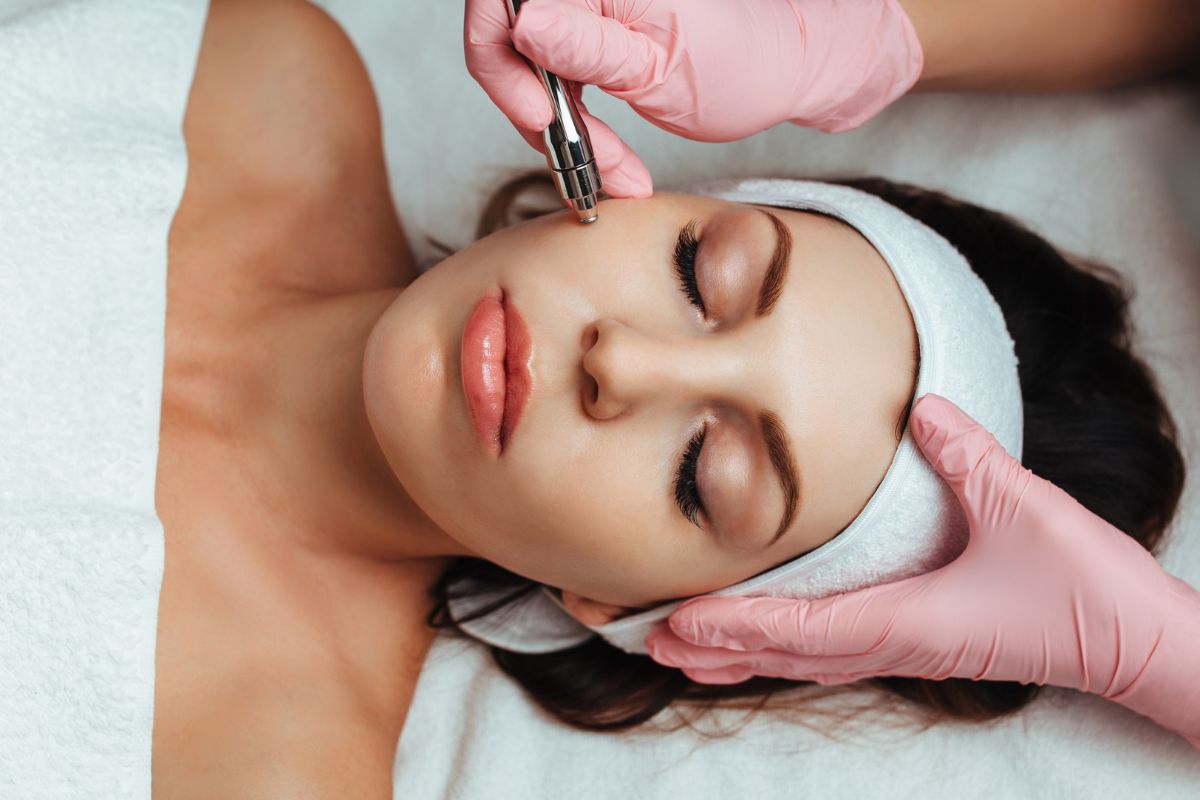 Microdermabrasion