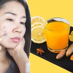 wellhealthorganic.com : remove dark spots on face tang – lemon juice