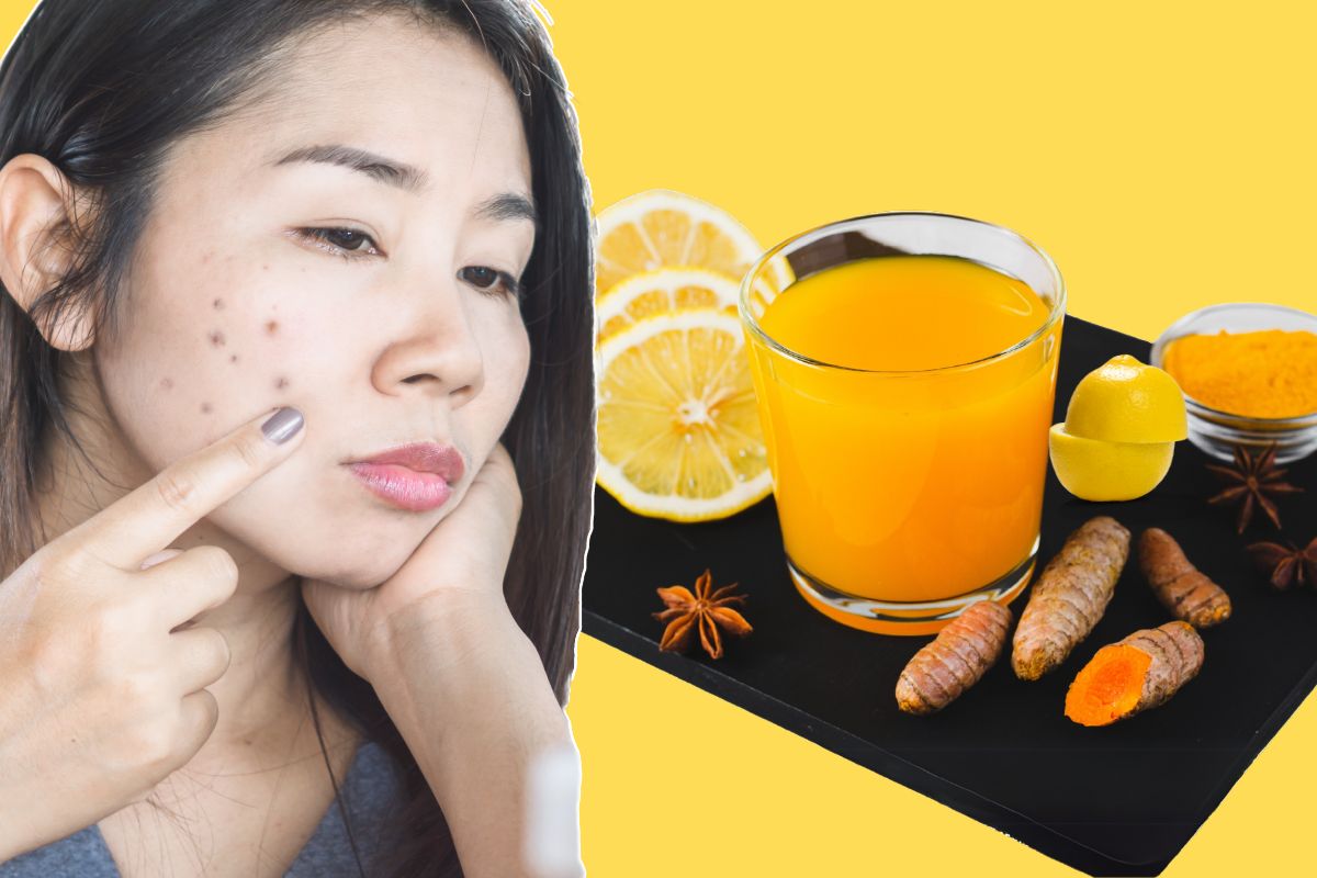 Wellhealthorganic.com : Remove Dark Spots on Face Tang – Lemon Juice